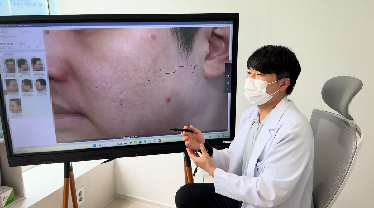 蚕室皮肤科医生看着电子白板上显示的脸颊皮肤照片进行咨询