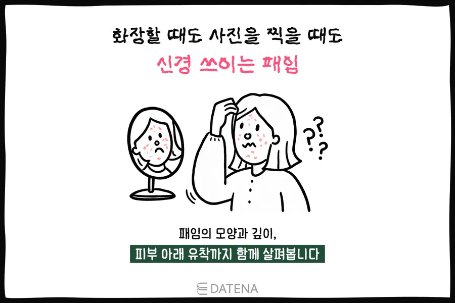 女性对镜查看脸颊上凹陷的痘坑,并表现化妆和拍照时在意凹陷的插图