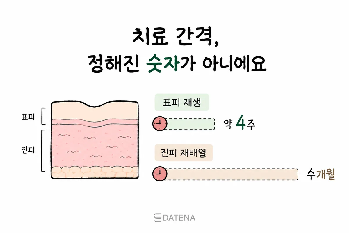 比较表皮再生约4周与真皮胶原蛋白重新排列需数月的治疗间隔示意图