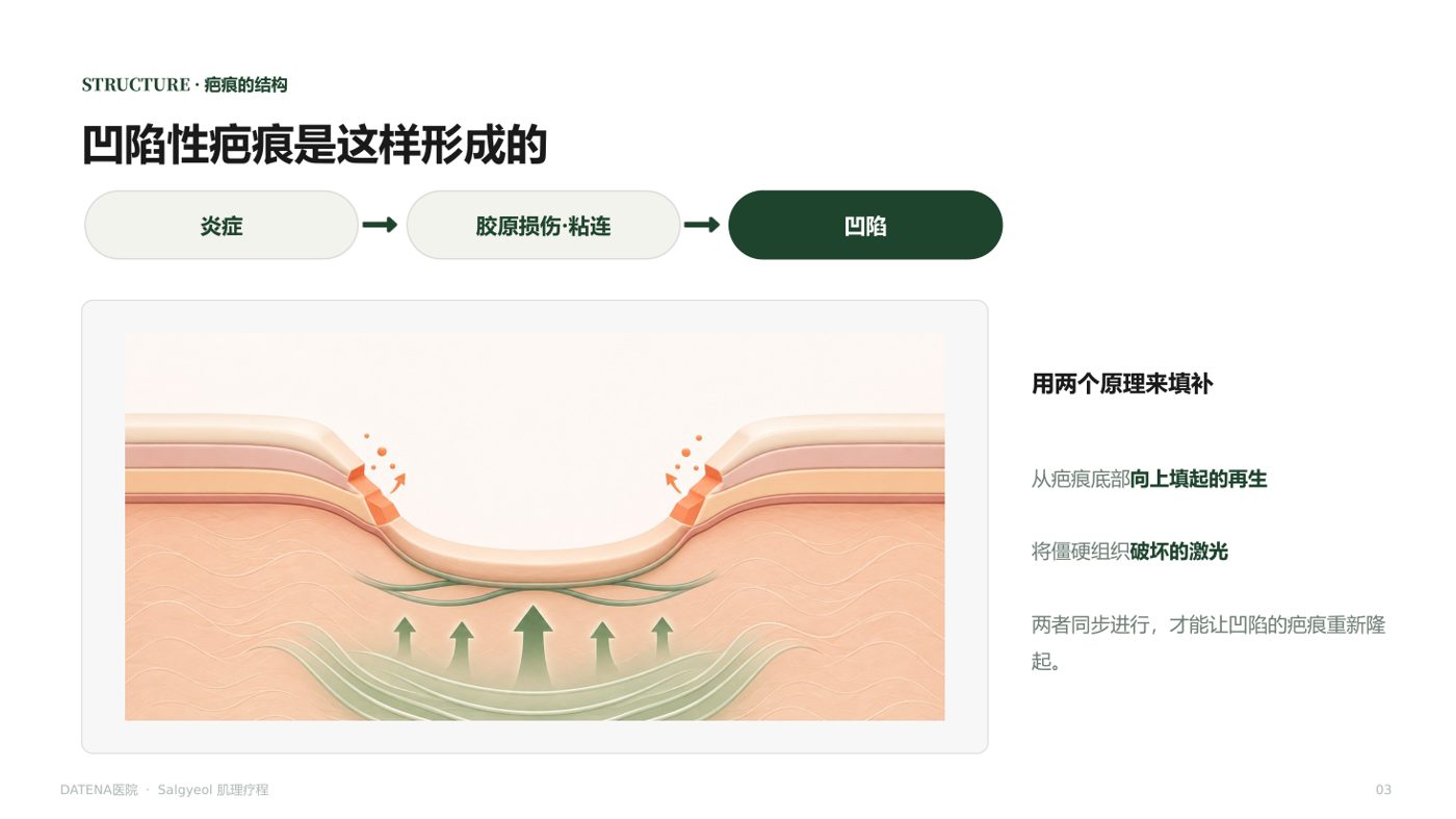 肌理再生疗法 咨询资料3